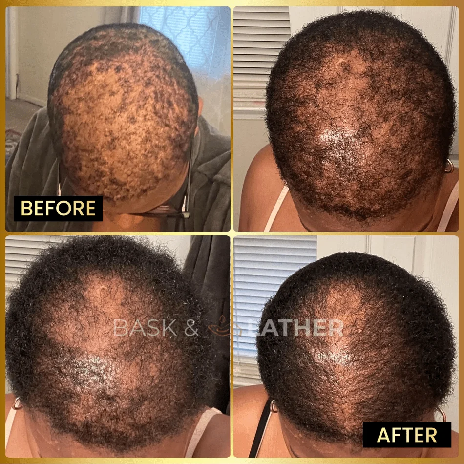 Men's Beard & Hair Growth Bundle - Image 5