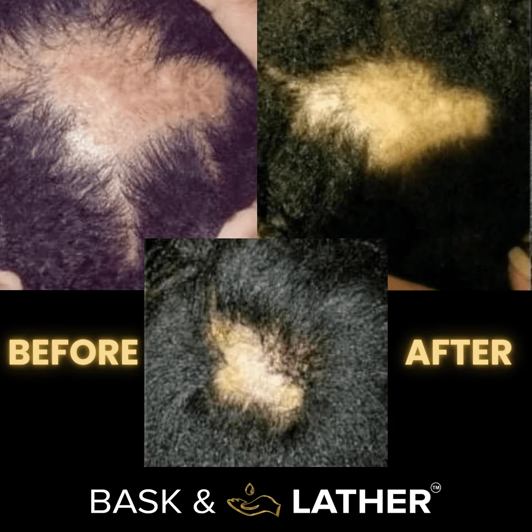 Scalp Stimulator | Hair Growth Oil - Image 8