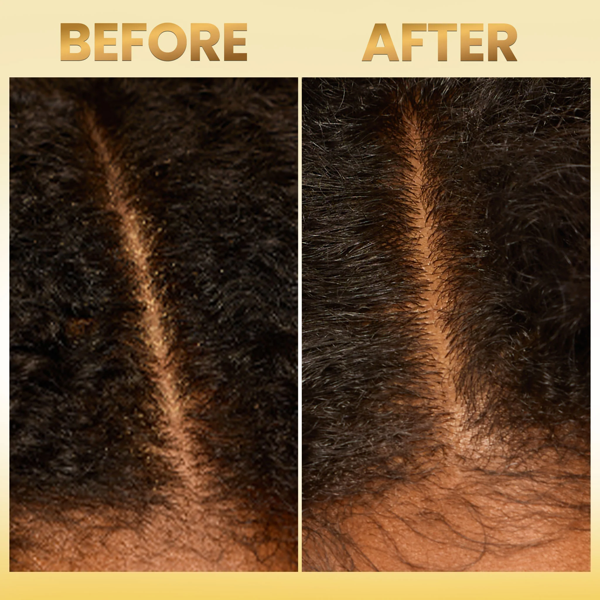 Scalp Therapy System - Image 6